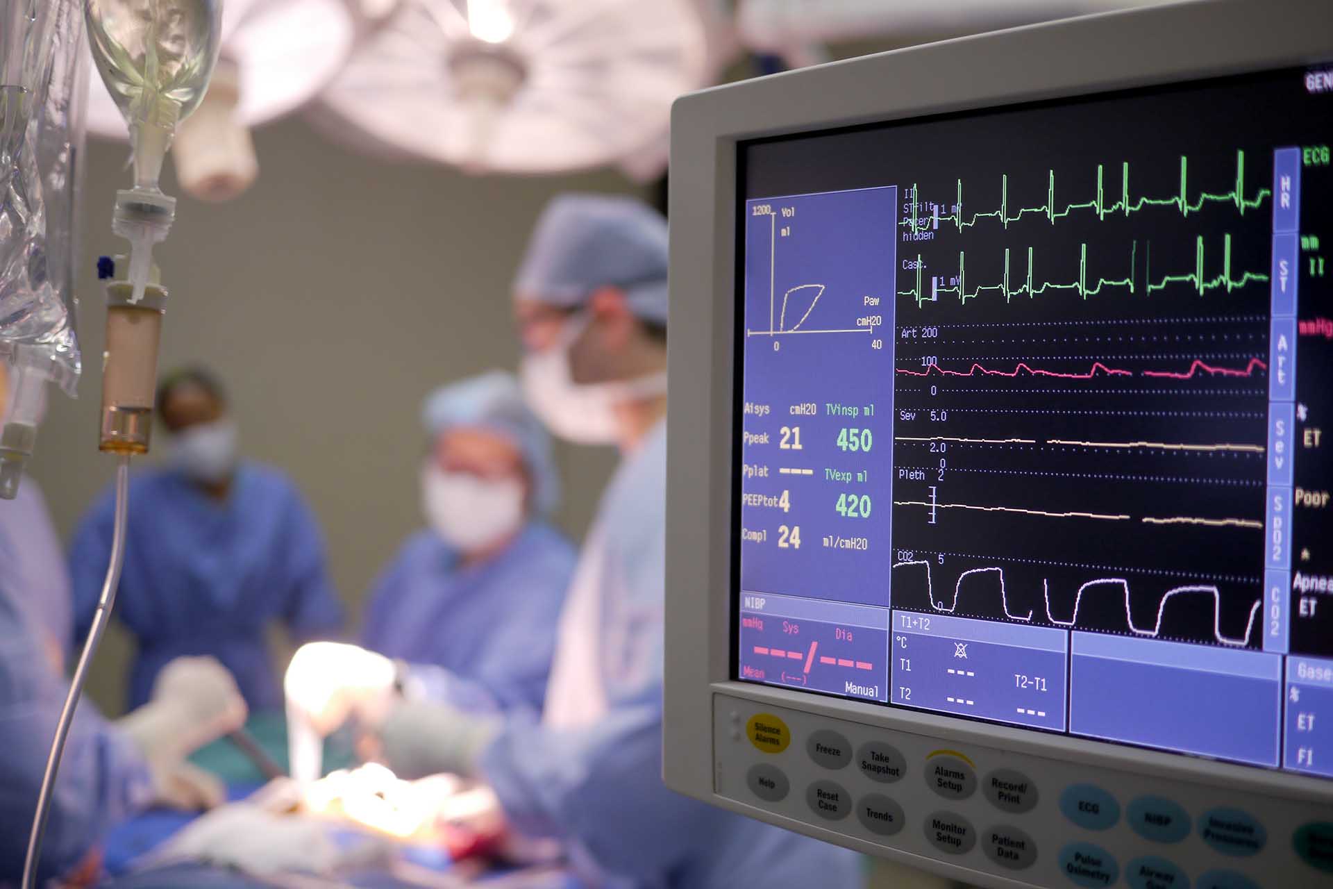 Heart monitor in surgery