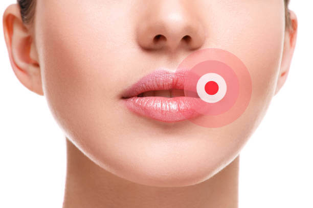 Lips Swelling: Symptoms, Causes, Treatment and More