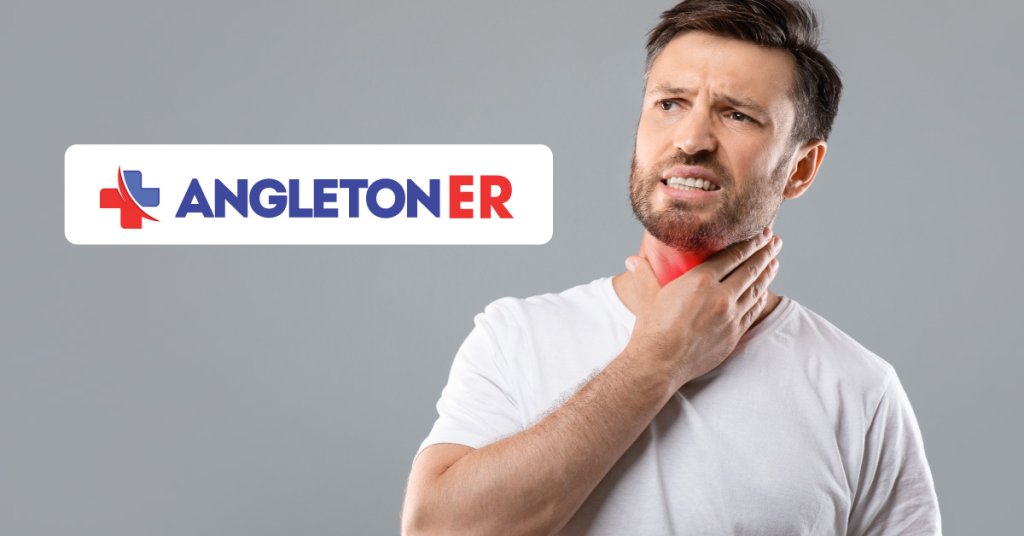 Strep Throat – Causes, Symptoms, and When to Seek Emergency Care 68 Strep Throat – Causes, Symptoms, and When to Seek Emergency Care