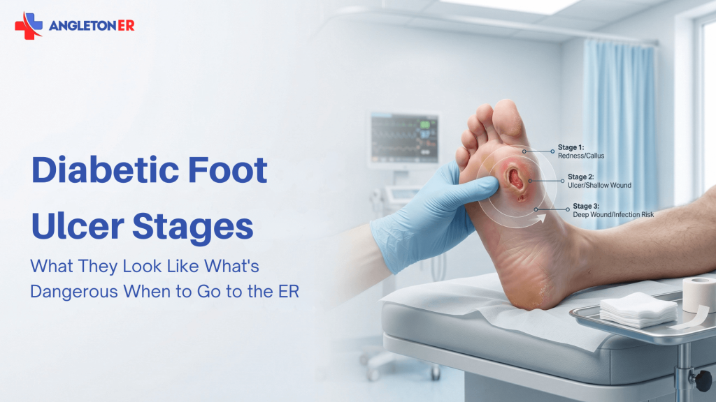 Diabetic Foot Ulcer Stages: What They Look Like, What’s Dangerous, and When to Go to the ER 1 Angleton ER graphic showing a clinician examining the bottom of a patient’s foot with a diabetic ulcer, labeled with ulcer stages from redness or callus to shallow wound and deep wound or infection risk.