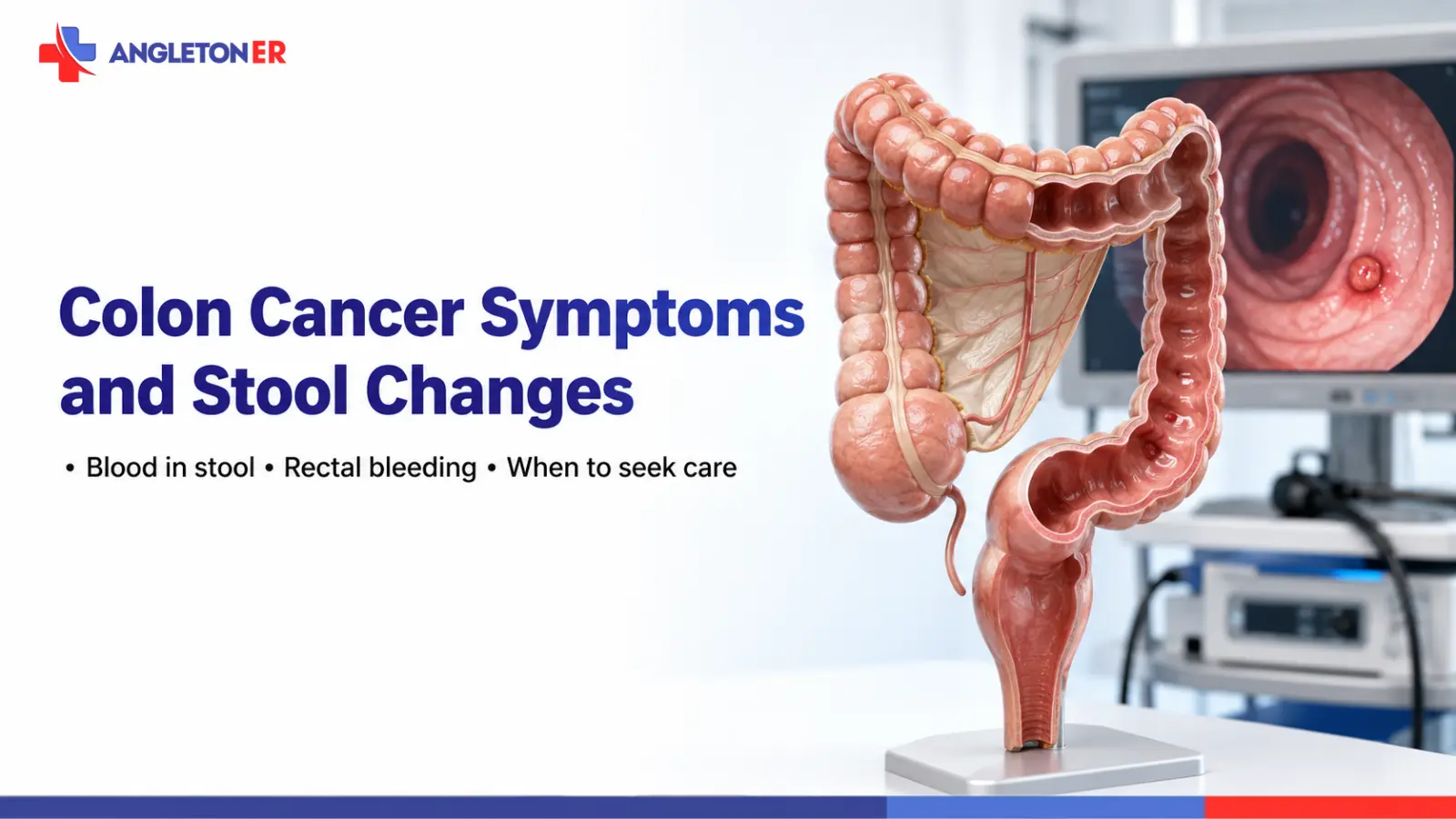 Colon cancer symptoms and stool changes featured image showing a colon model and colonoscopy view, highlighting blood in stool, rectal bleeding, and when to seek care.