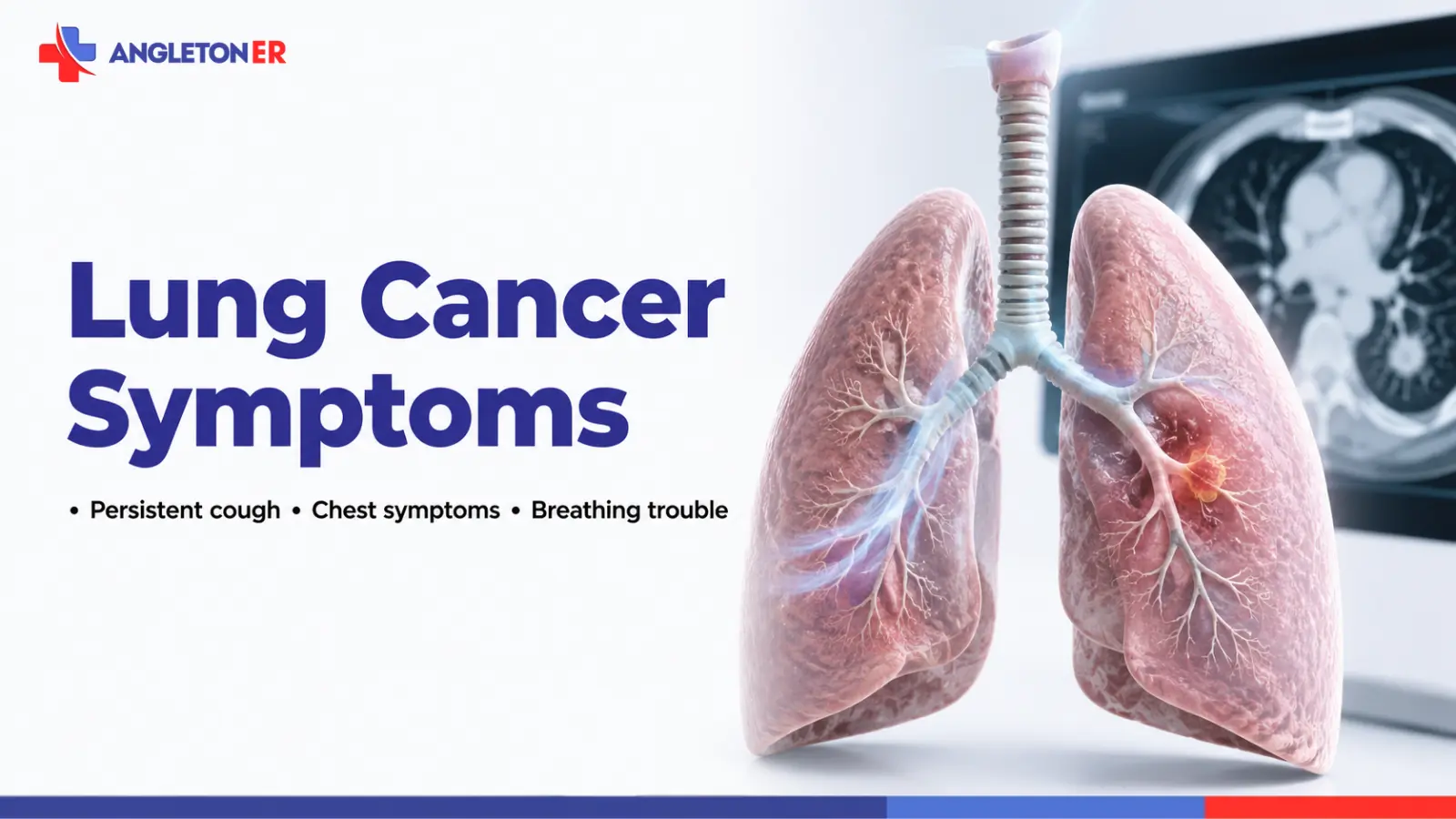 Lung cancer symptoms featured image showing a lung tumor and chest scan, highlighting persistent cough, chest symptoms, and breathing trouble.