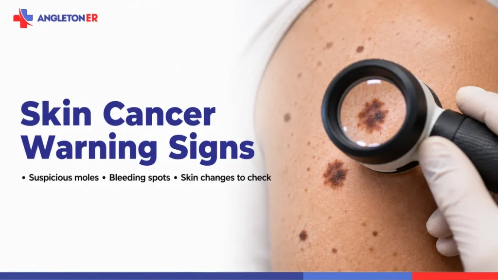 Skin Cancer Warning Signs: Suspicious Moles, Bleeding Spots, and Skin Changes to Check 1 Skin cancer warning signs featured image showing suspicious moles examined with a dermatoscope, highlighting bleeding spots and concerning skin changes.
