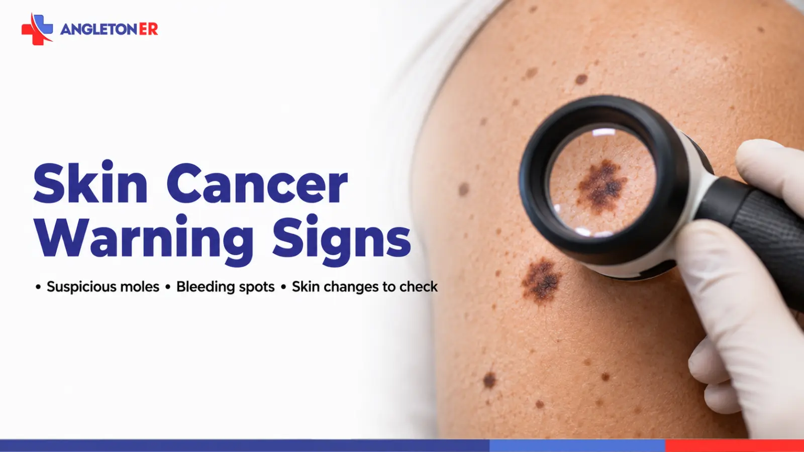 Skin Cancer Warning Signs: Suspicious Moles, Bleeding Spots, and Skin Changes to Check