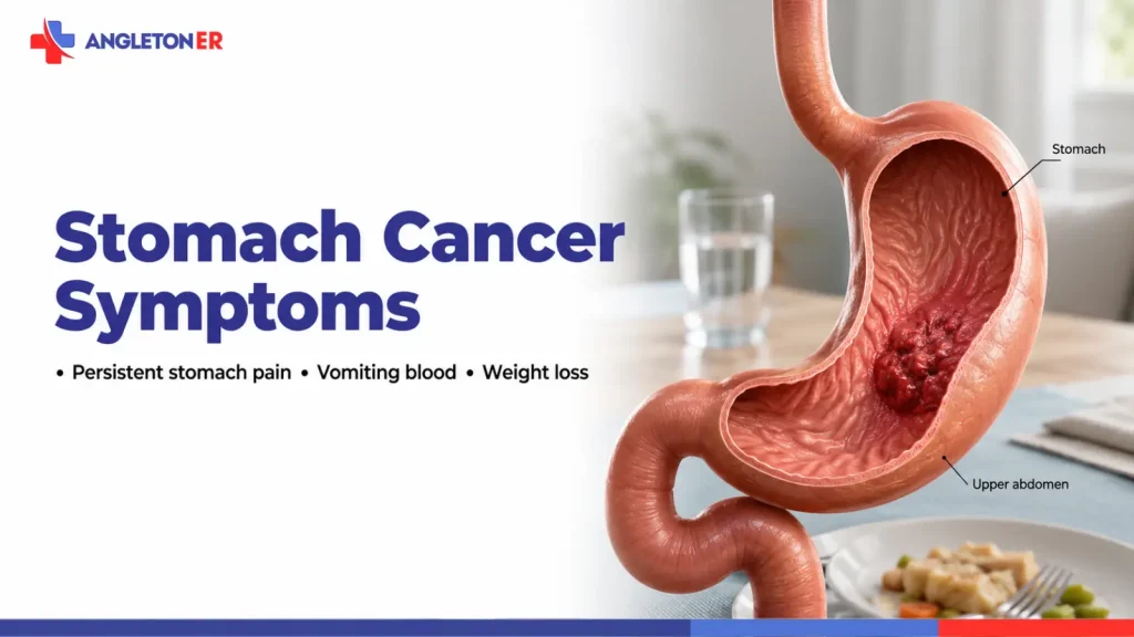 Stomach Cancer Symptoms: Persistent Stomach Pain, Vomiting Blood, Weight Loss, and When to Seek Care 9 Stomach cancer symptoms featured image showing a stomach tumor and upper abdomen, highlighting persistent stomach pain, vomiting blood, and unexplained weight loss.