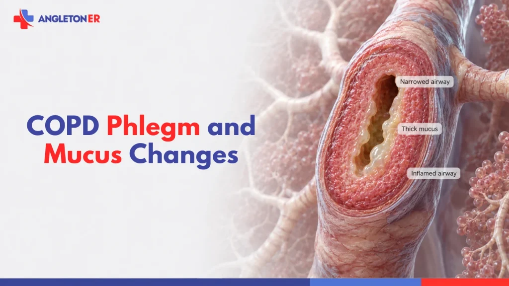 COPD phlegm and mucus changes showing thick mucus, airway inflammation, and narrowing of the airways.