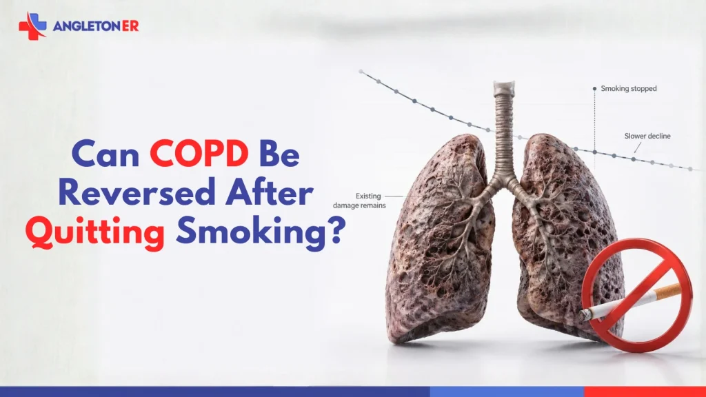COPD lung damage after quitting smoking, showing that stopping smoking can slow disease progression but cannot reverse existing lung damage.